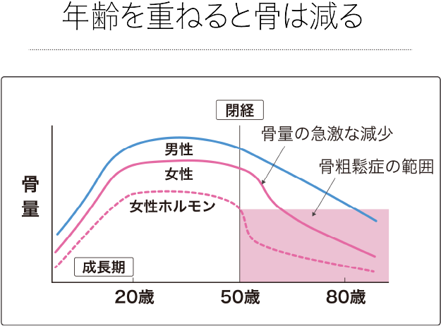 年齢を重ねると骨は減る