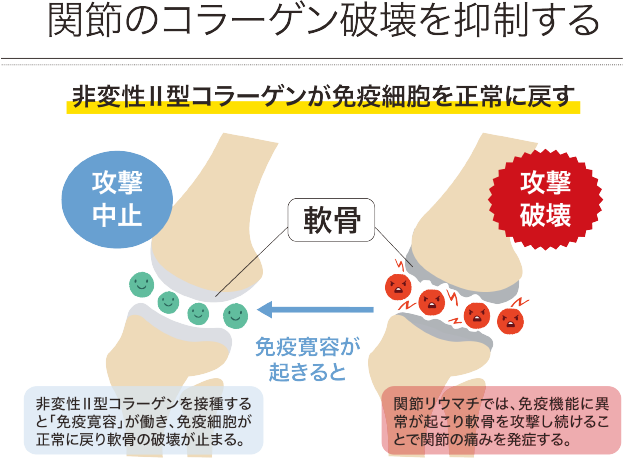 関節のコラーゲン破壊を抑制する